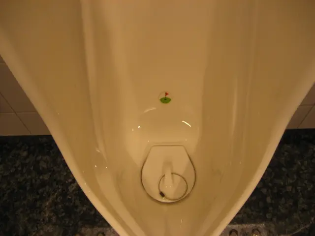 Urinary Tract Infections (UTIs) Frequently Linked to Pyuria - A Common Connection